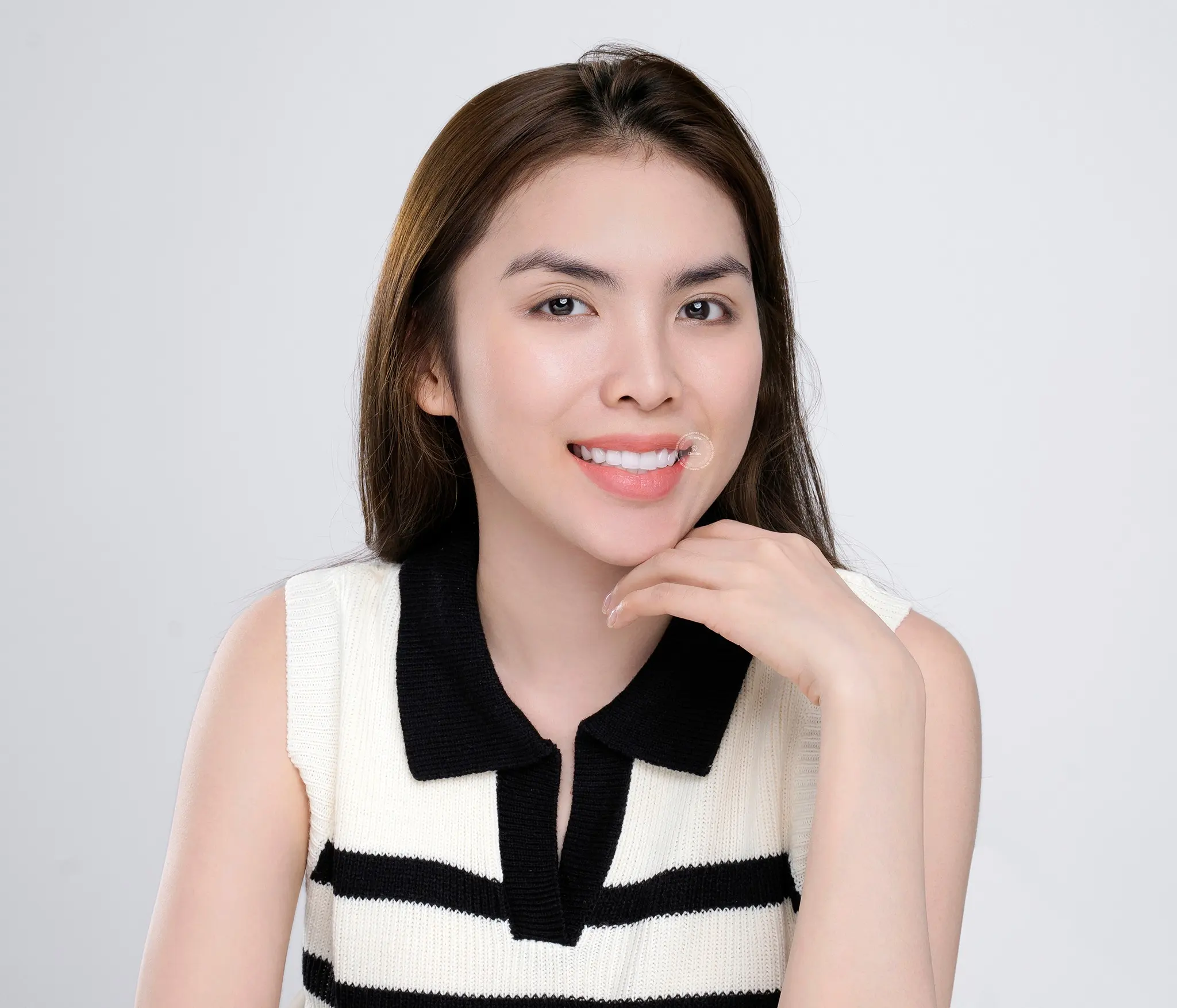 Tuổi thọ răng sứ Zirconia được bao lâu?
